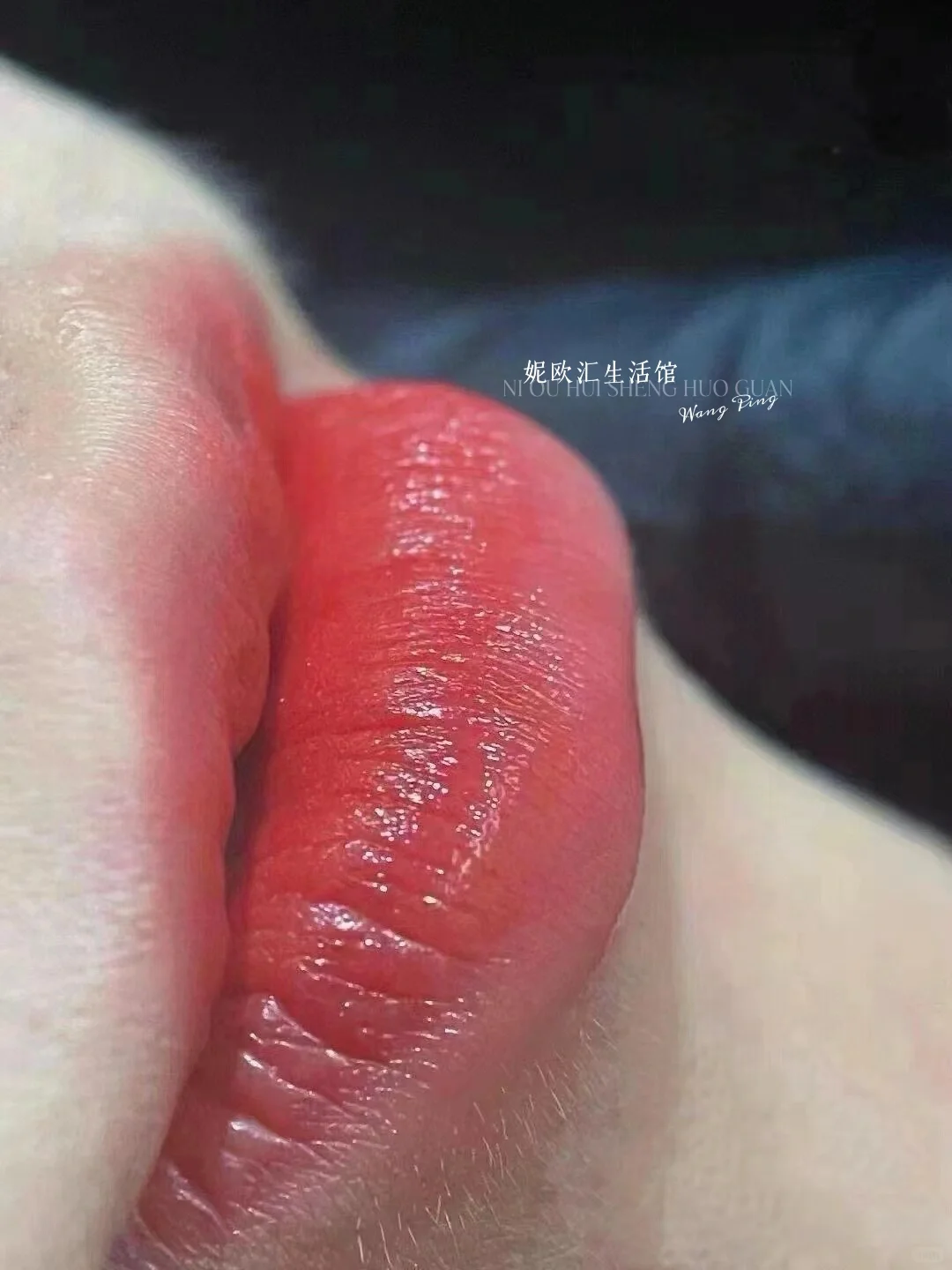 幼态又自然的妈生唇👄