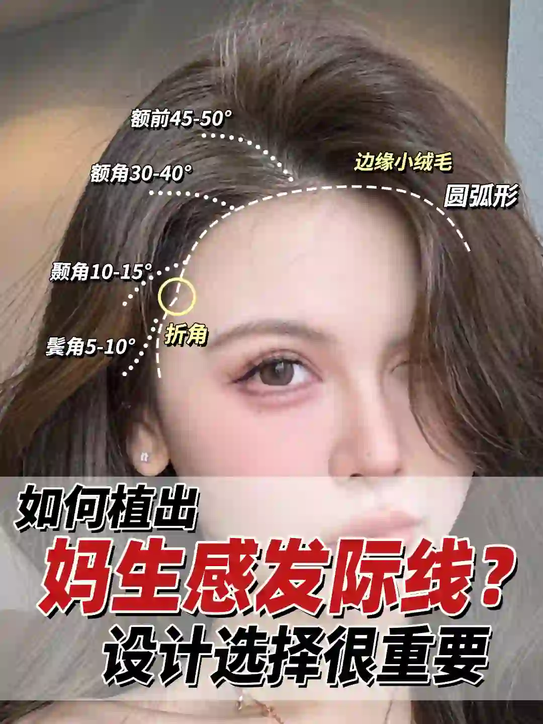 被全网抄的妈生毛流感发际线模板?速来❗