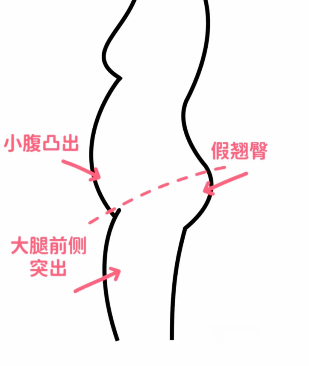 啊啊……终于找到解救这种体型的办法啦，有用