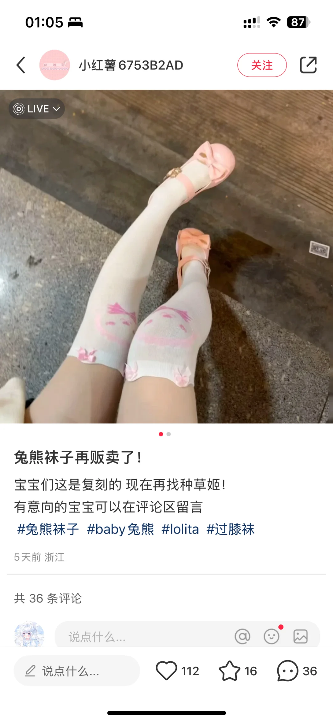 天呐真的这种腿腿好好看好卡哇