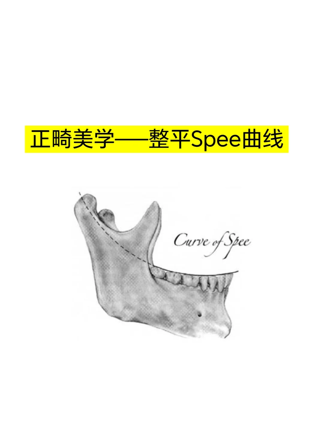 正畸美学——整平Spee曲线