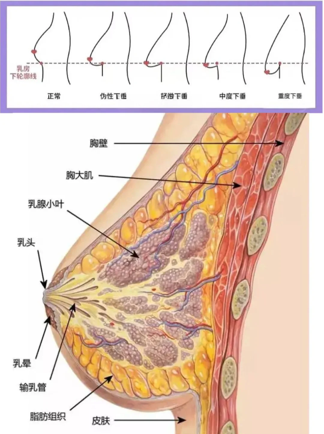 姑娘们你们对胸下垂了解多少⁉️