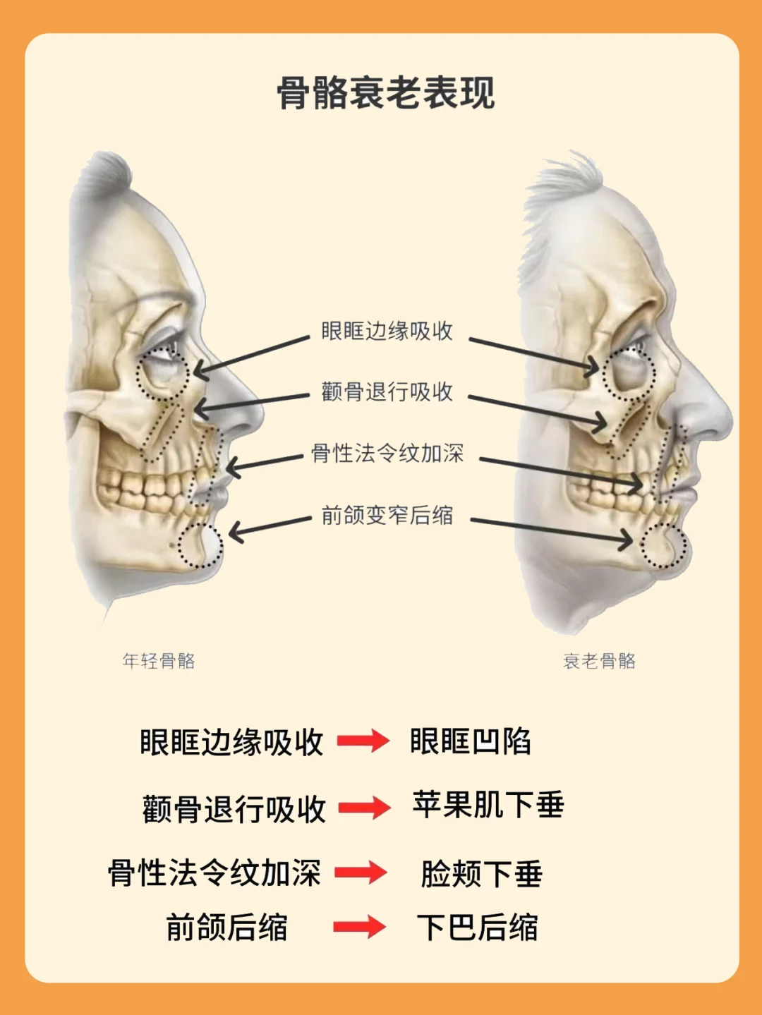 6个月瘦了40斤如何不垮脸的原因㊙️