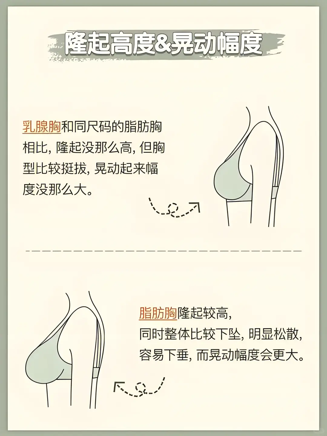 脂肪胸或乳腺胸如何区别