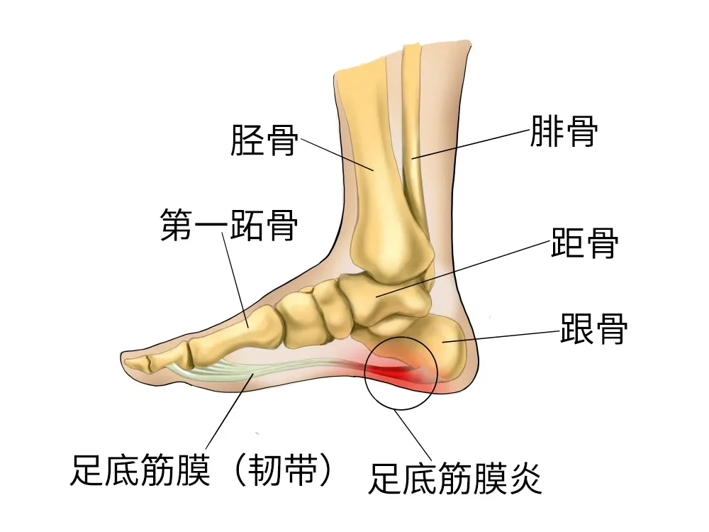 女性新型刑具‼️这个组合简直相当于裹小脚