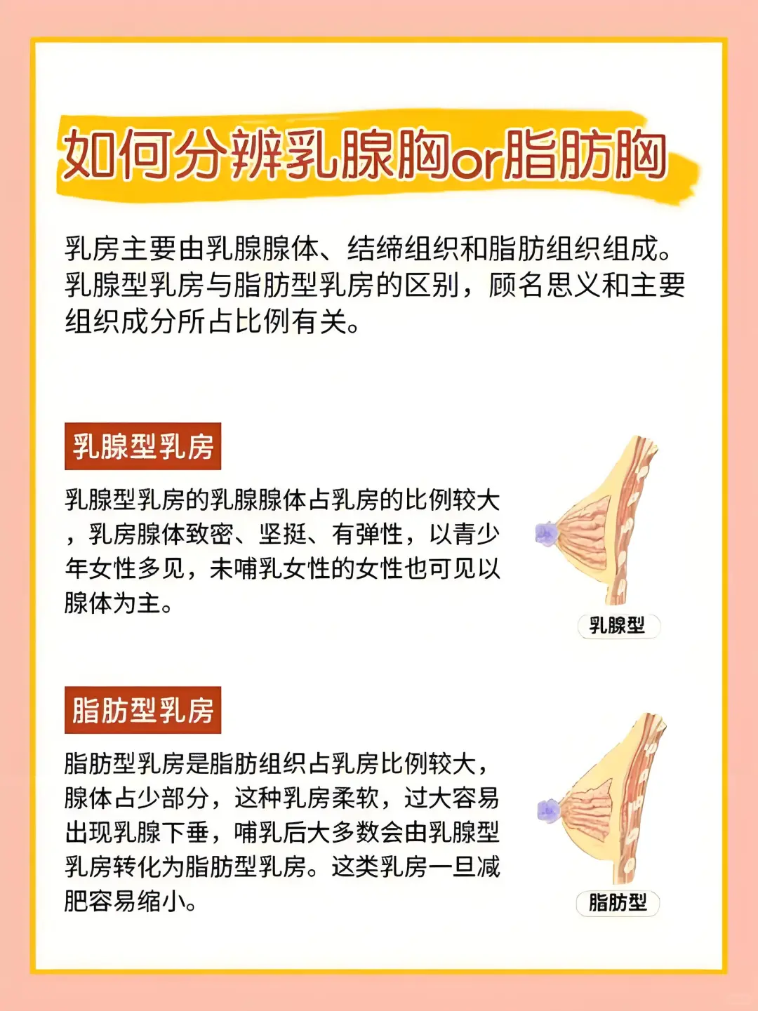 脂肪胸或乳腺胸如何区别