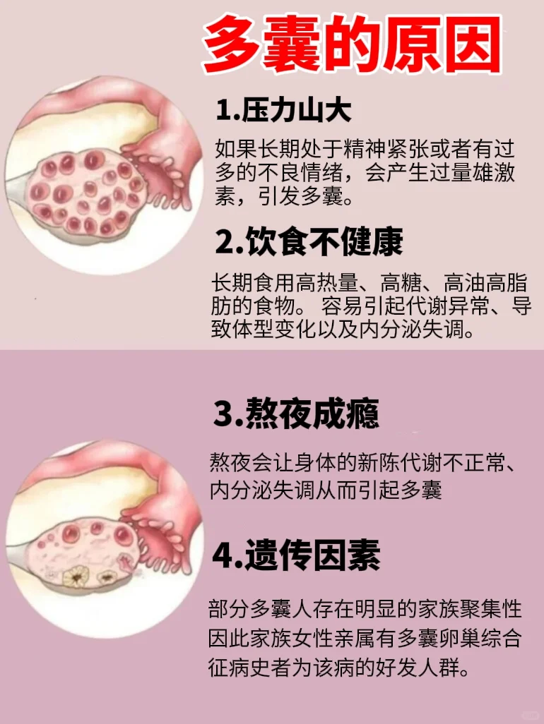 有多囊女和无多囊女的区别，一次看懂！