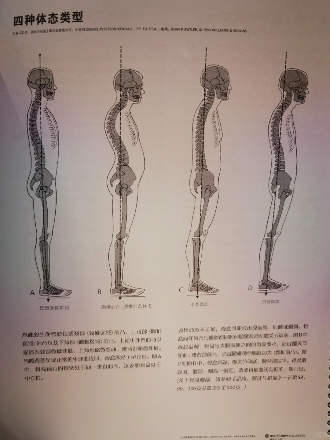 四种常见体态