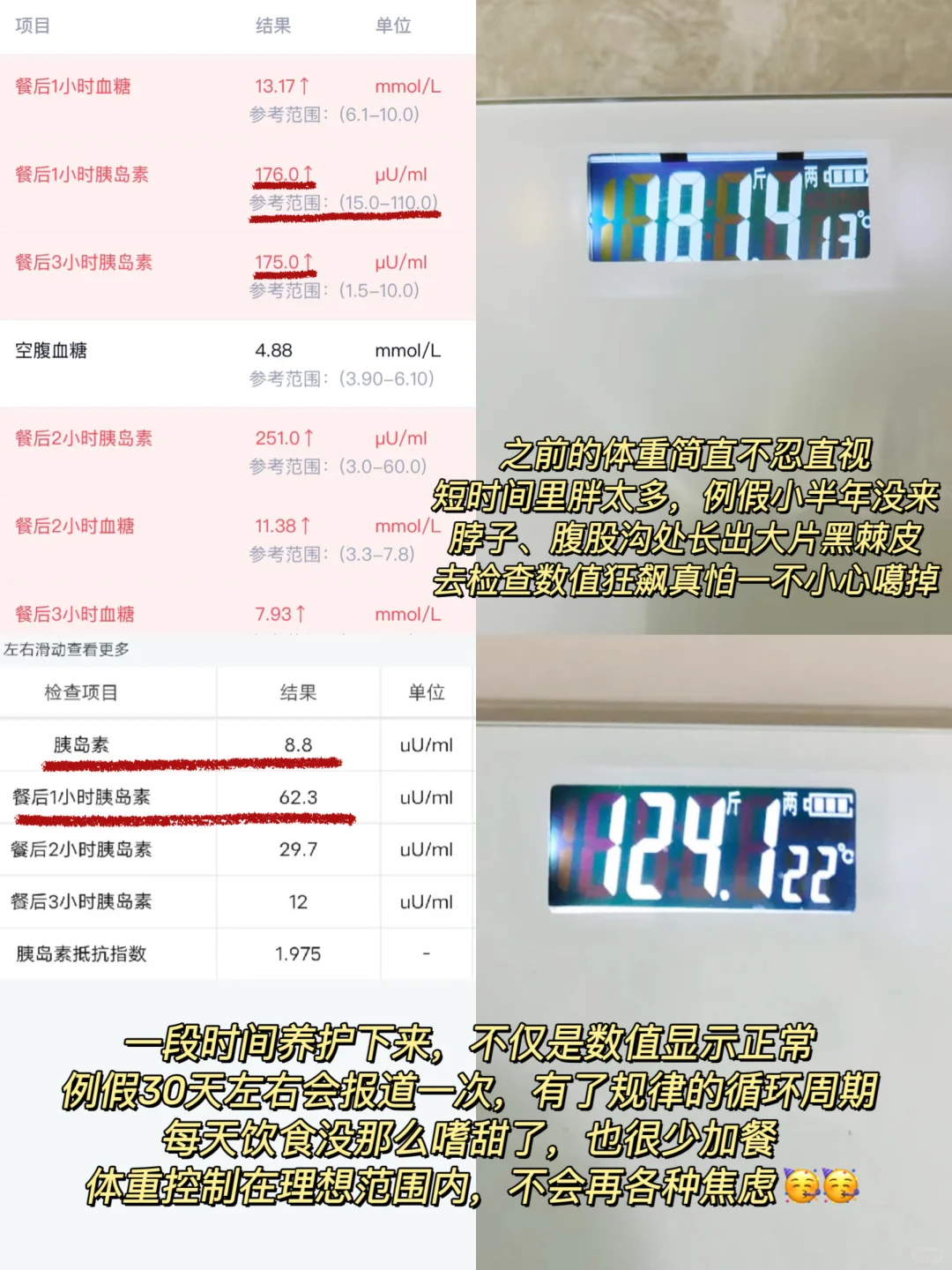 有胰岛抵抗的?住，能帮一个是一个‼