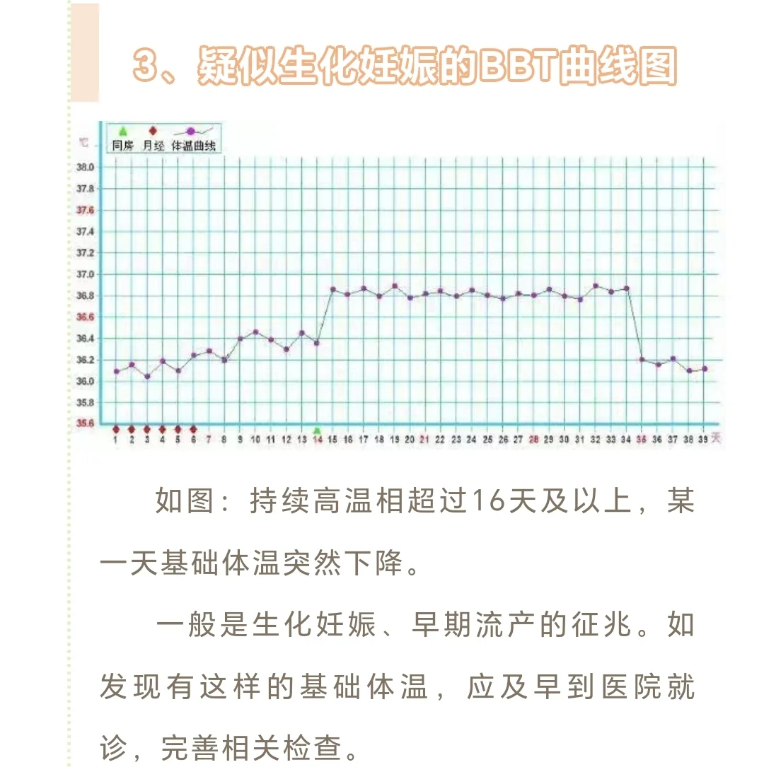 你的基础体温图是哪种？