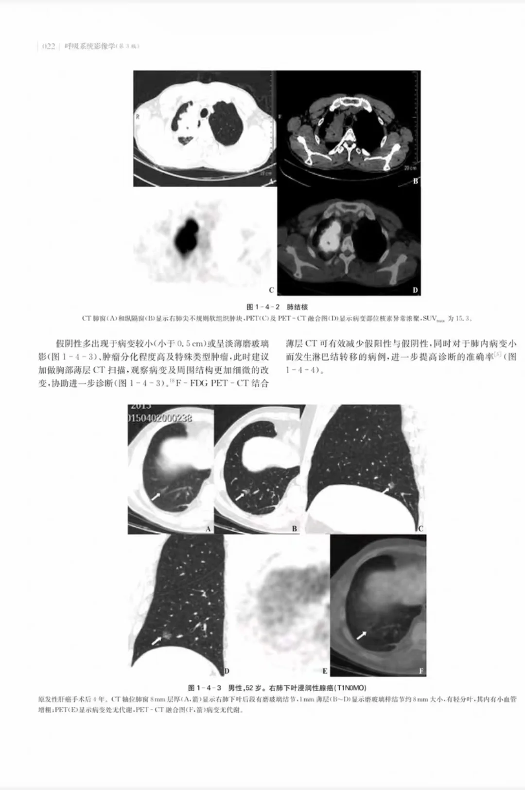 【PDF版】呼吸系统影像学第3版pdf电子书