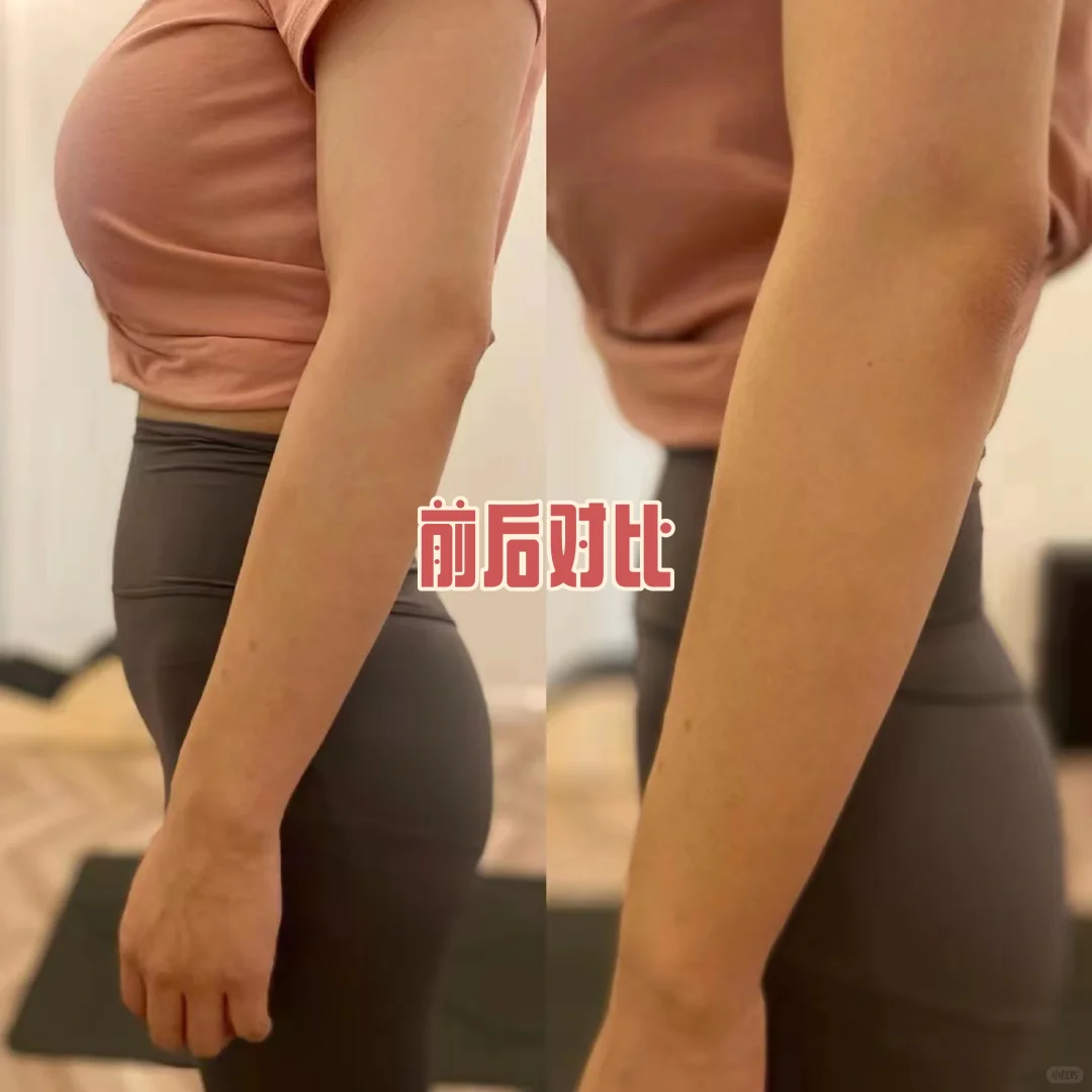 女孩子为什么要练瑜伽，有什么好处？