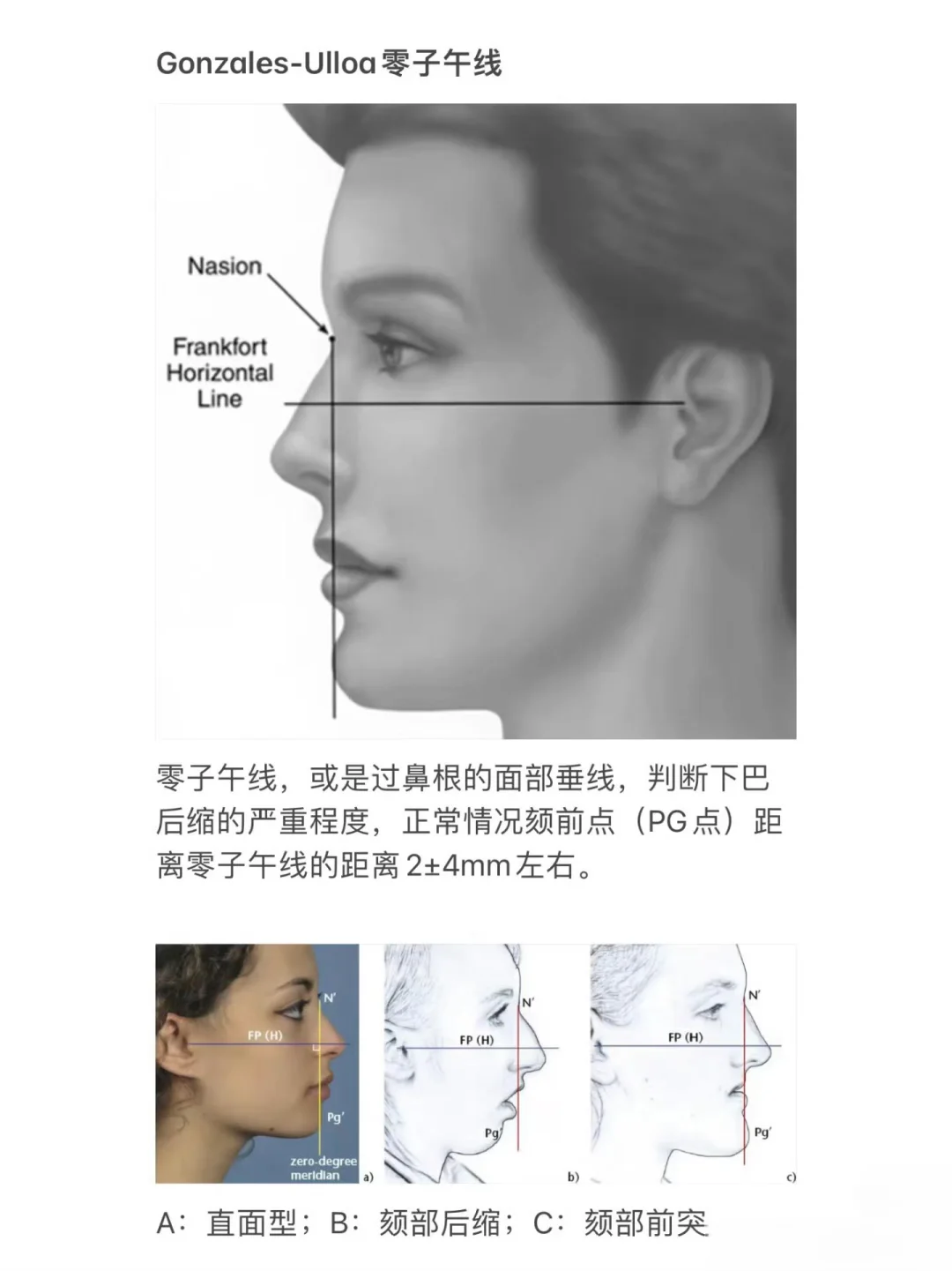 赵露思的下巴为什么没人说⁉️