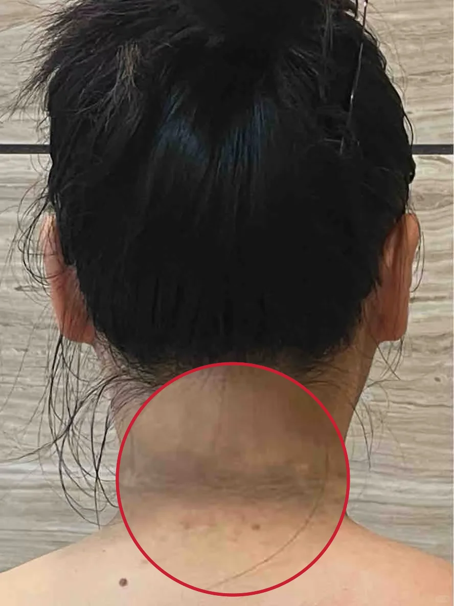 我妈带我去看脖子黑，我悟了！