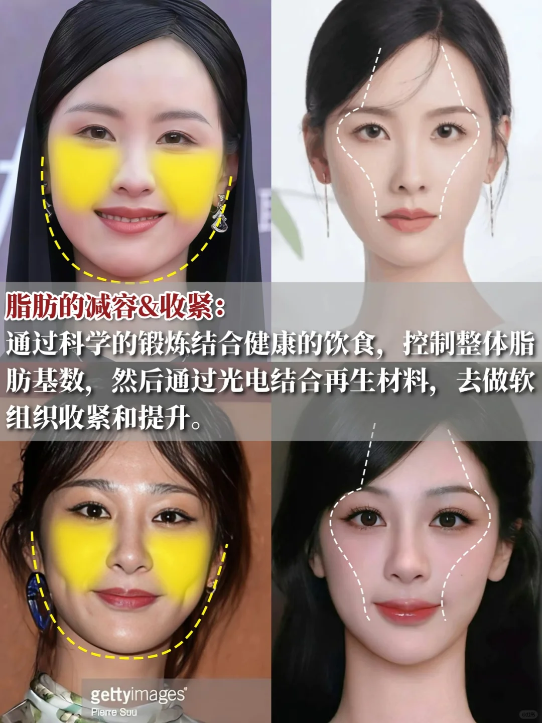 又是一位离婚就变美的方圆脸女⭐️