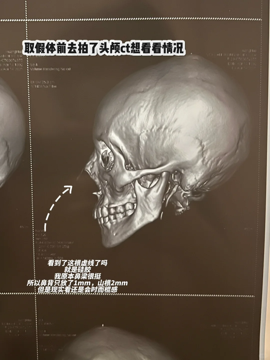 被网友锐评为是老天爷追着喂饭吃的骨相……