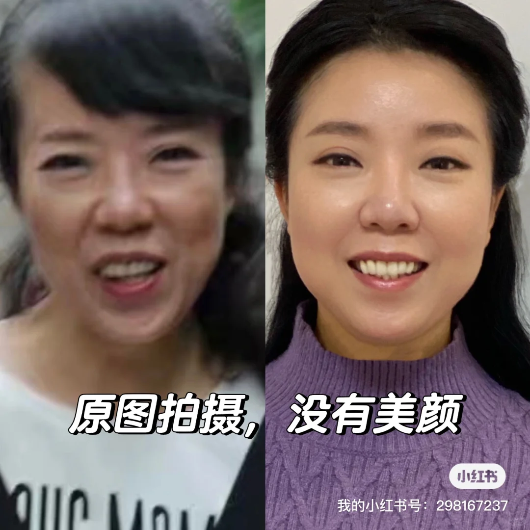干瘪衰老的脸，如何变饱满年轻，干货分享3