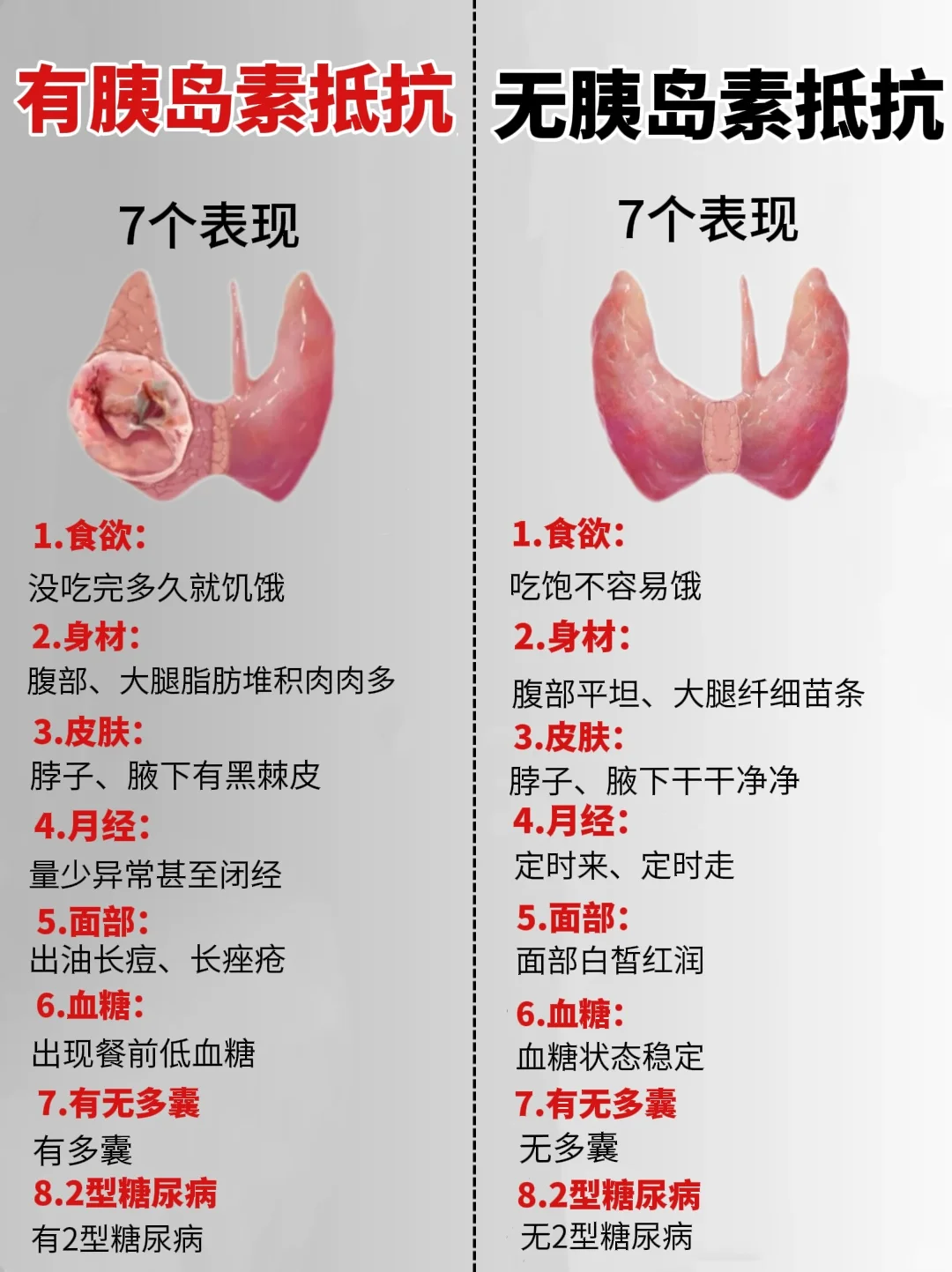 其实很多人都不知道自己重度胰岛素抵抗了..