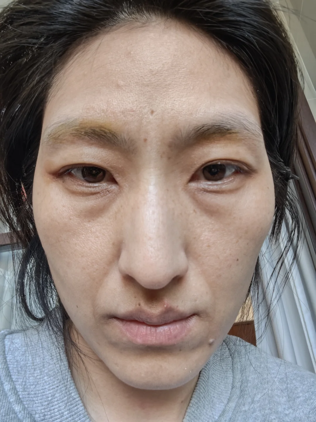 容貌焦虑的宝宝看看我就好了