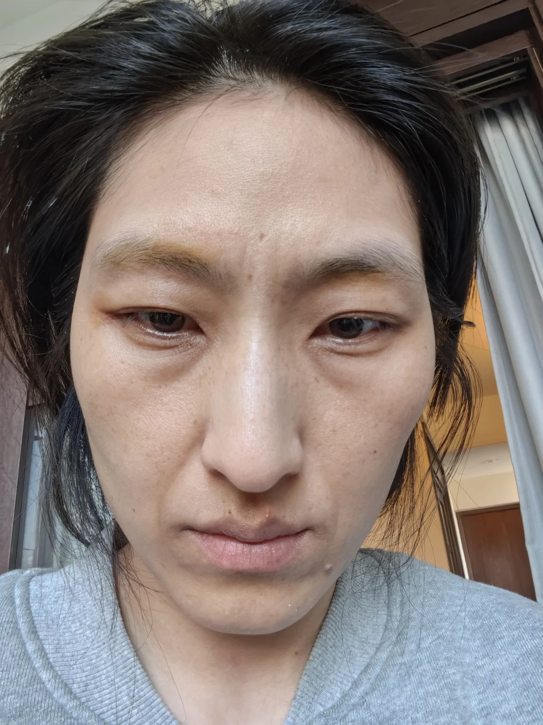 容貌焦虑的宝宝看看我就好了