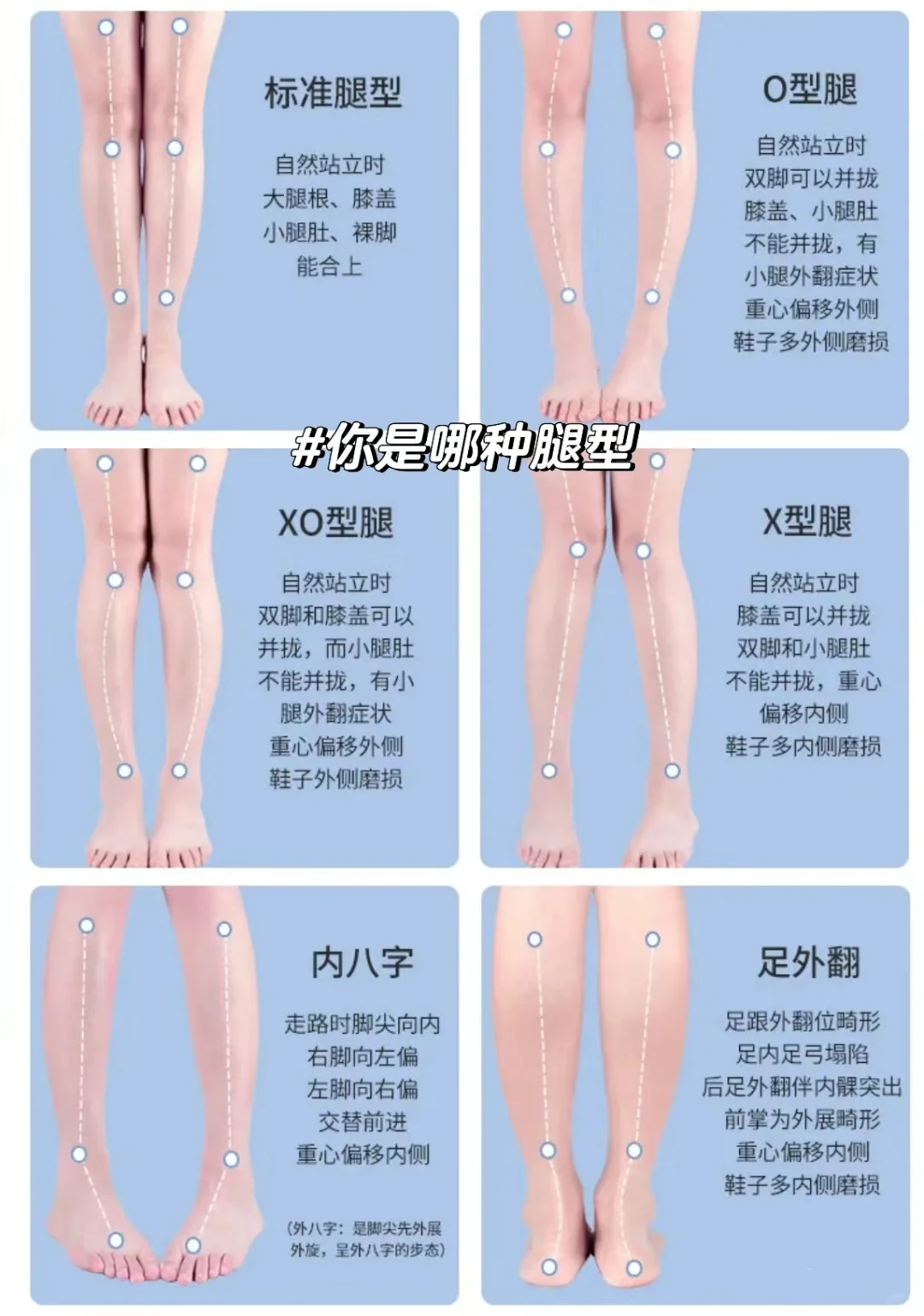 腿型改善|20s判断你的腿型！附矫正动作！