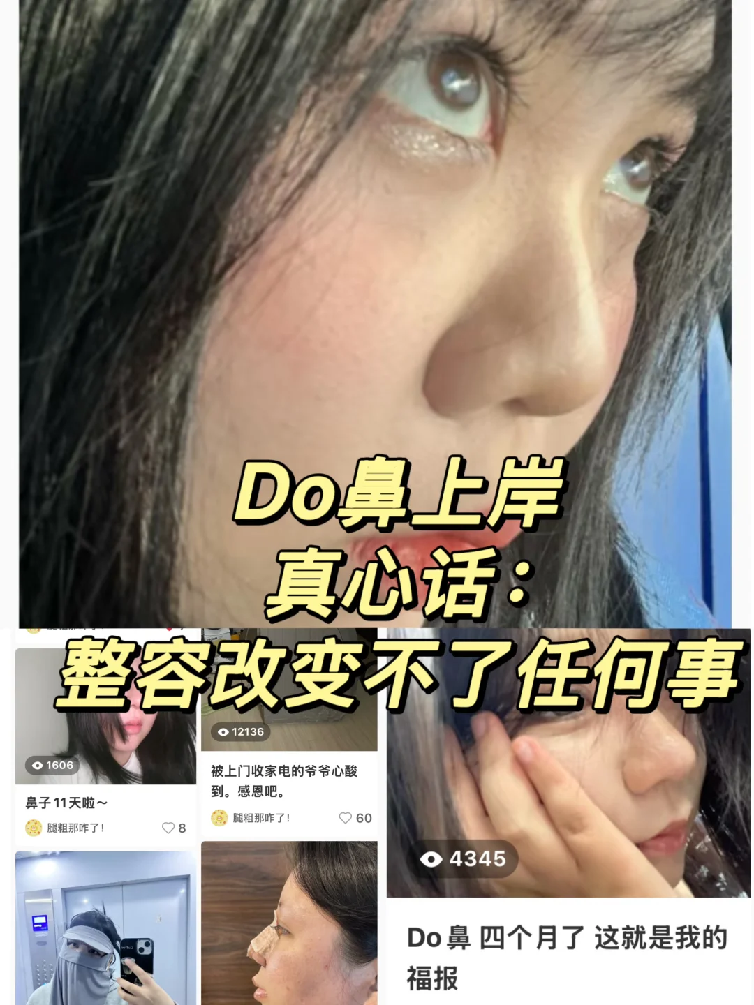 劝所有准备do👃得女生，整容不等于改ming