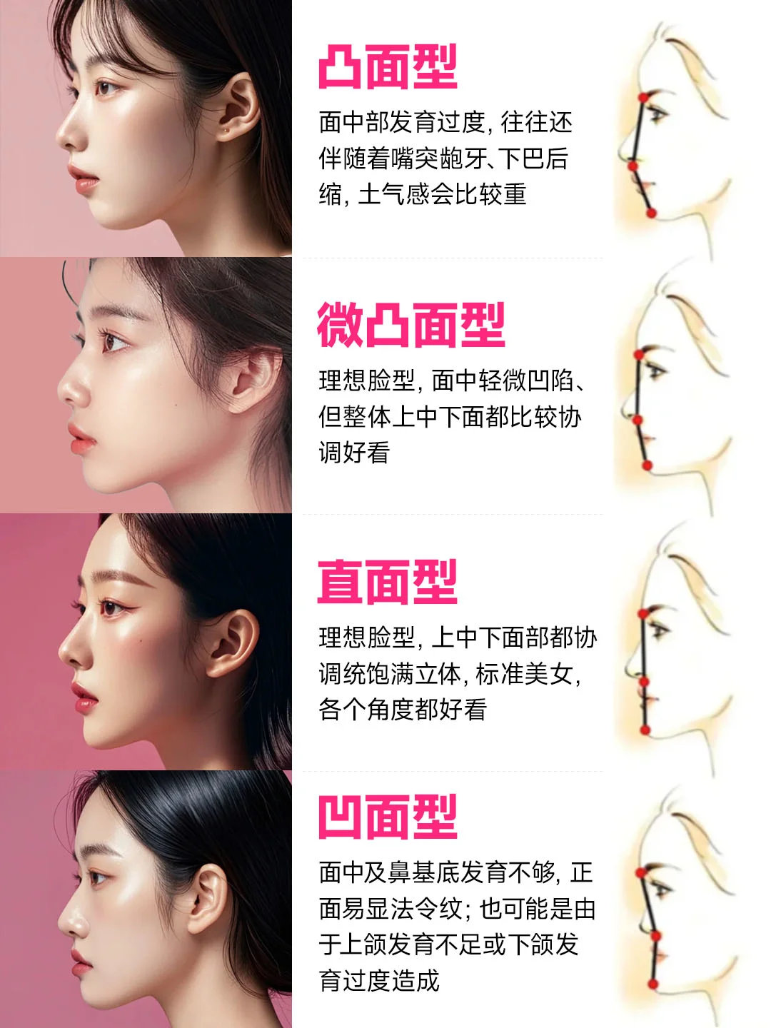 有懂的吗侧脸好看的关键是这个吗