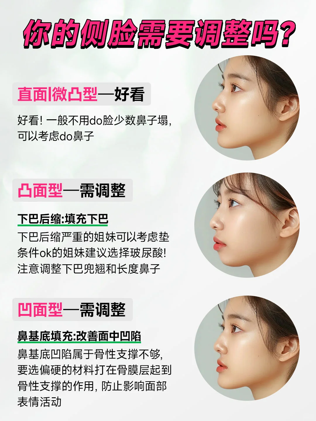 有懂的吗侧脸好看的关键是这个吗