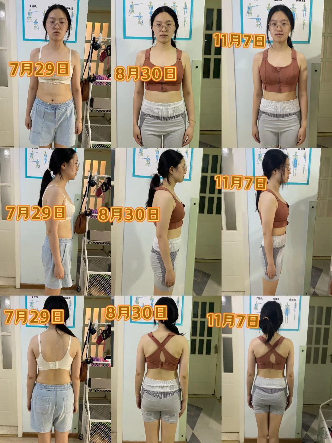 你的体态真的“定型”了吗？✨10个专属名额
