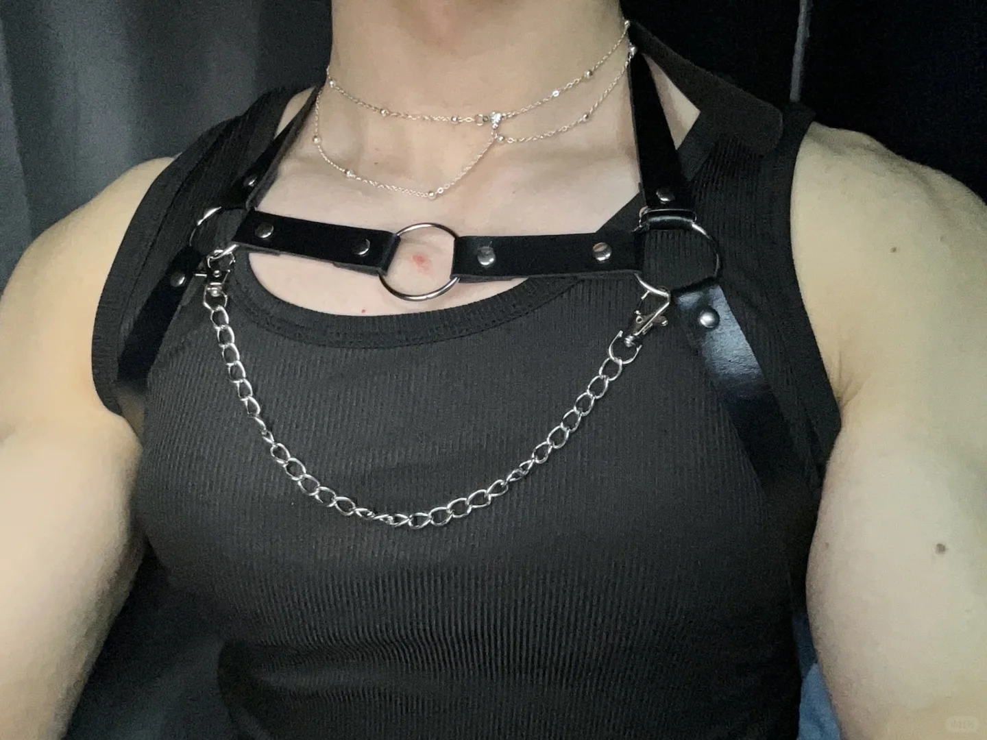 胸口长了一颗痘痘