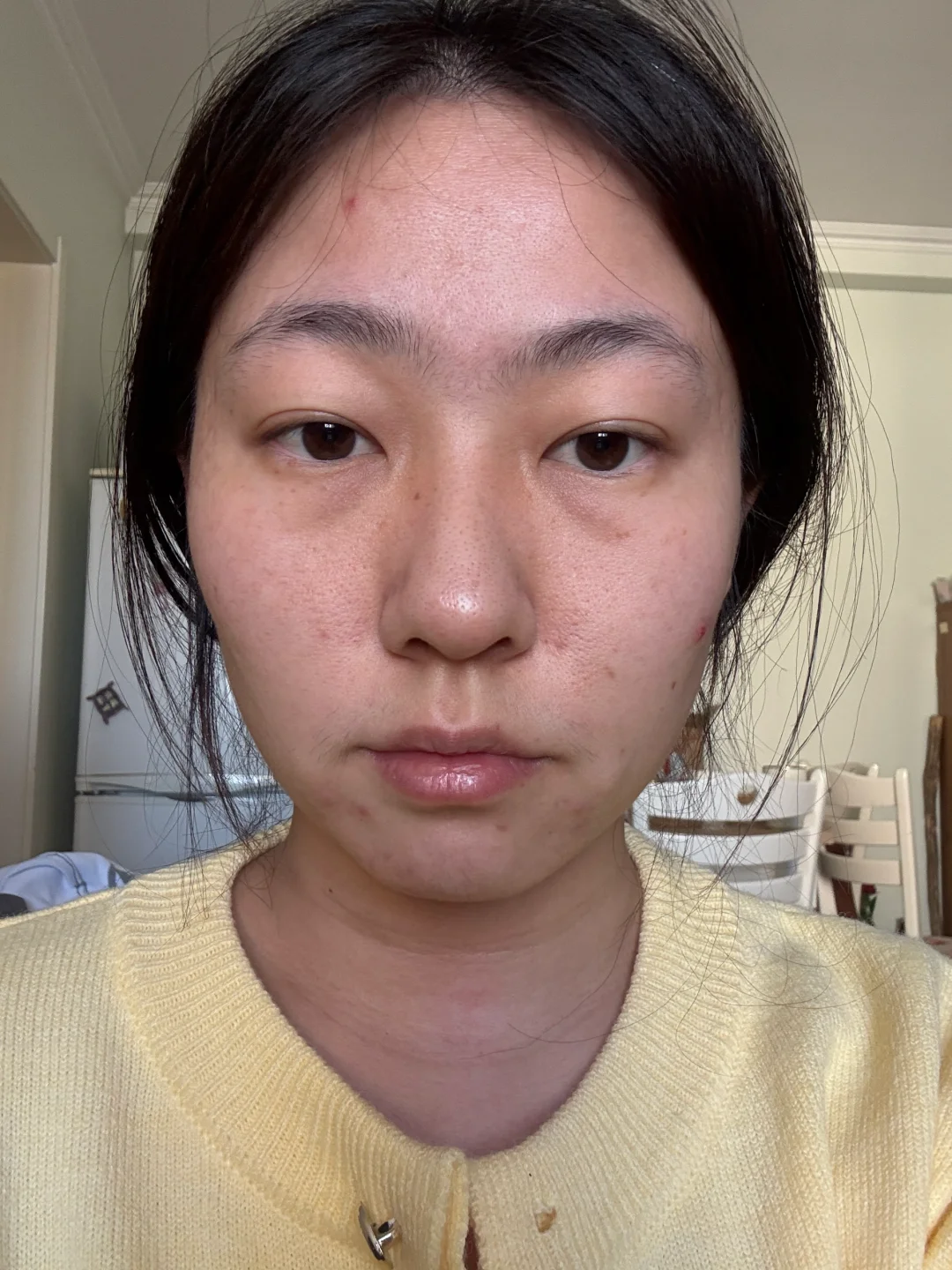 纯素颜状态好差啊，求推荐好用的护肤品！