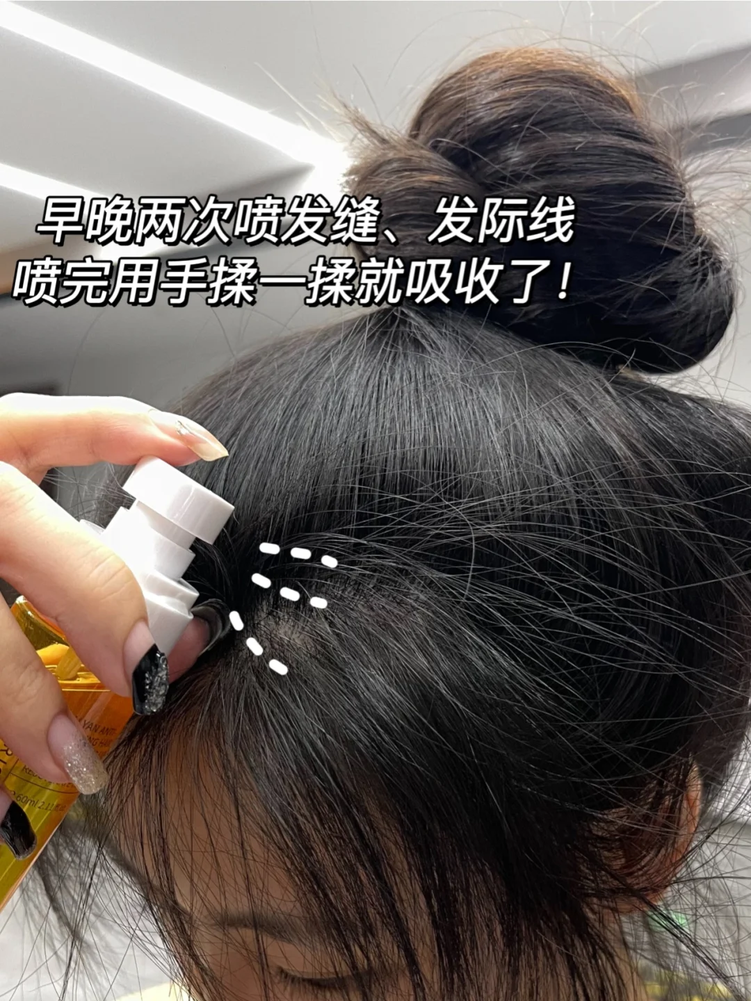 脱发党快喷！现在头发多到都嫌重了！！