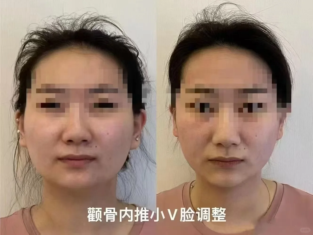 非遗传承徒手骨骼精雕