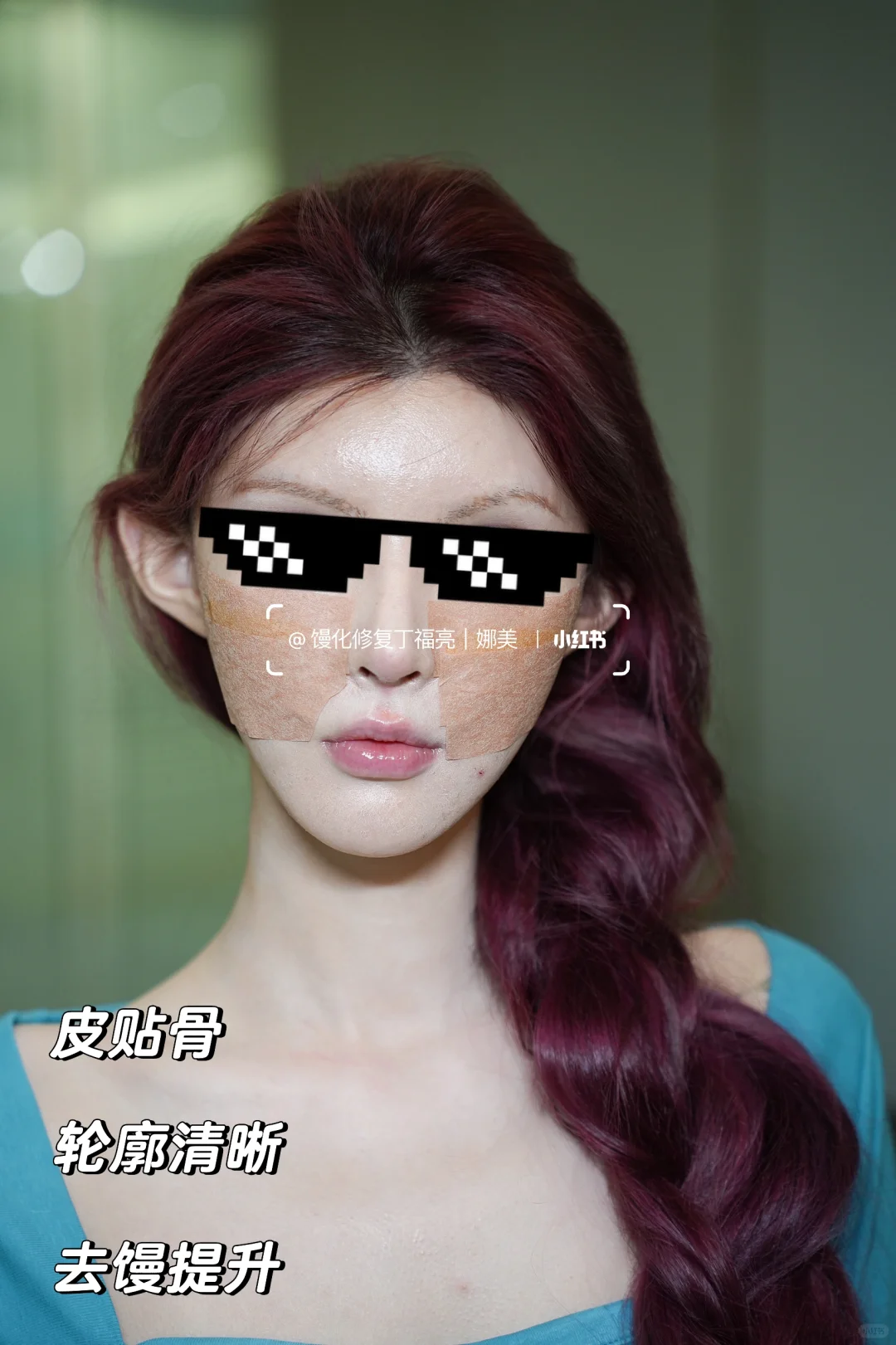 百万网红“真人芭比”do脸修复，全网首发️