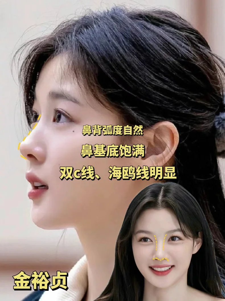 韩国塌鼻子、低山根的女星惊艳众人！