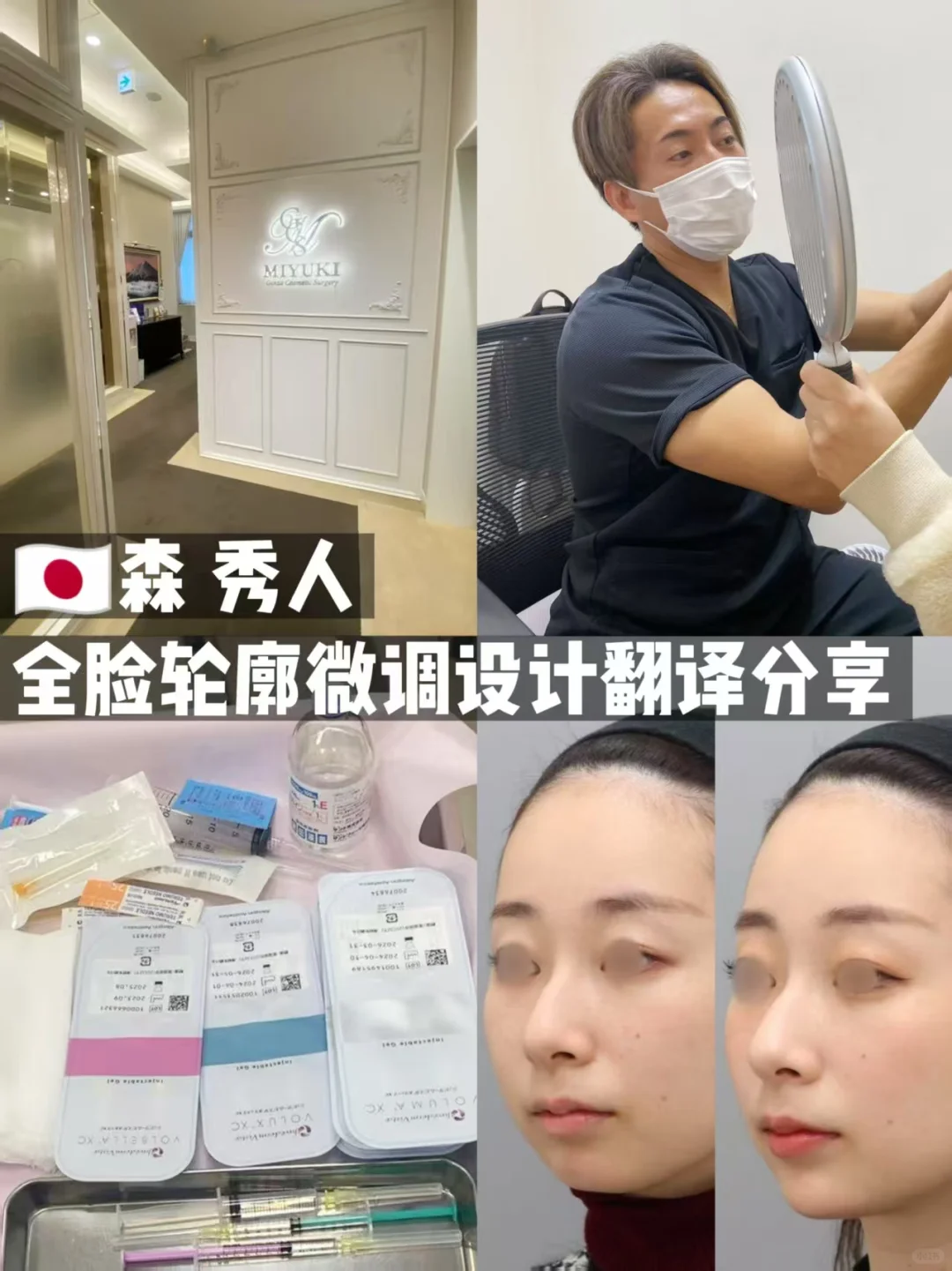 🇯🇵医美翻译：森秀人全脸微调设计方案