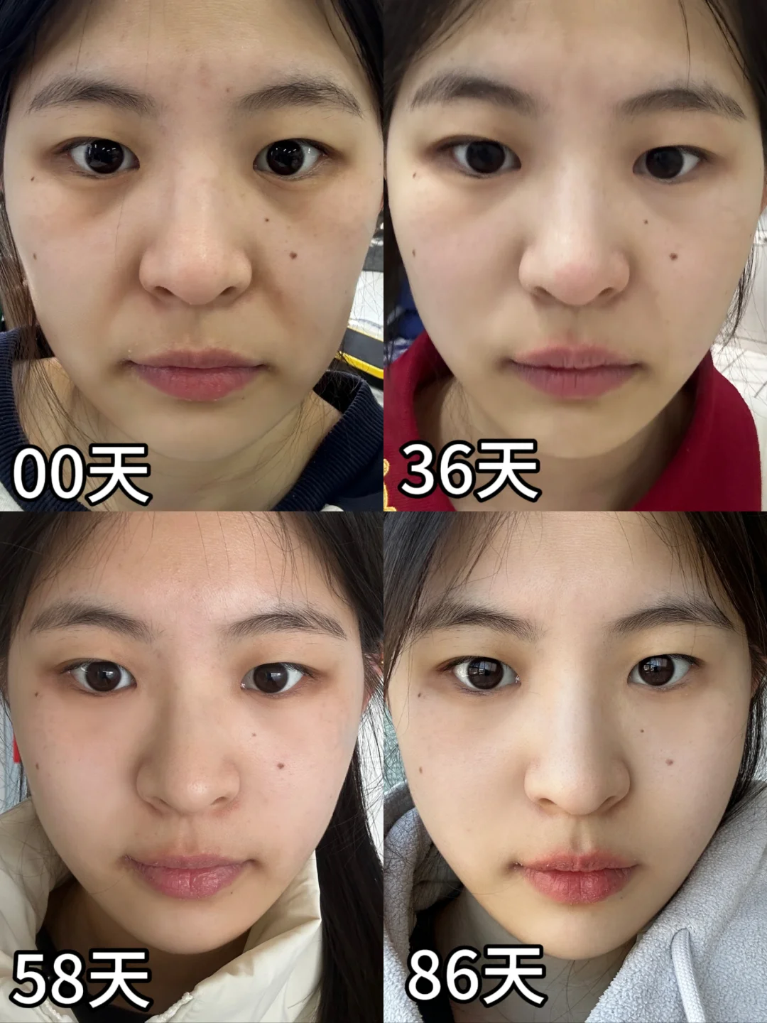 女大学生面部瑜伽打卡82天反馈...