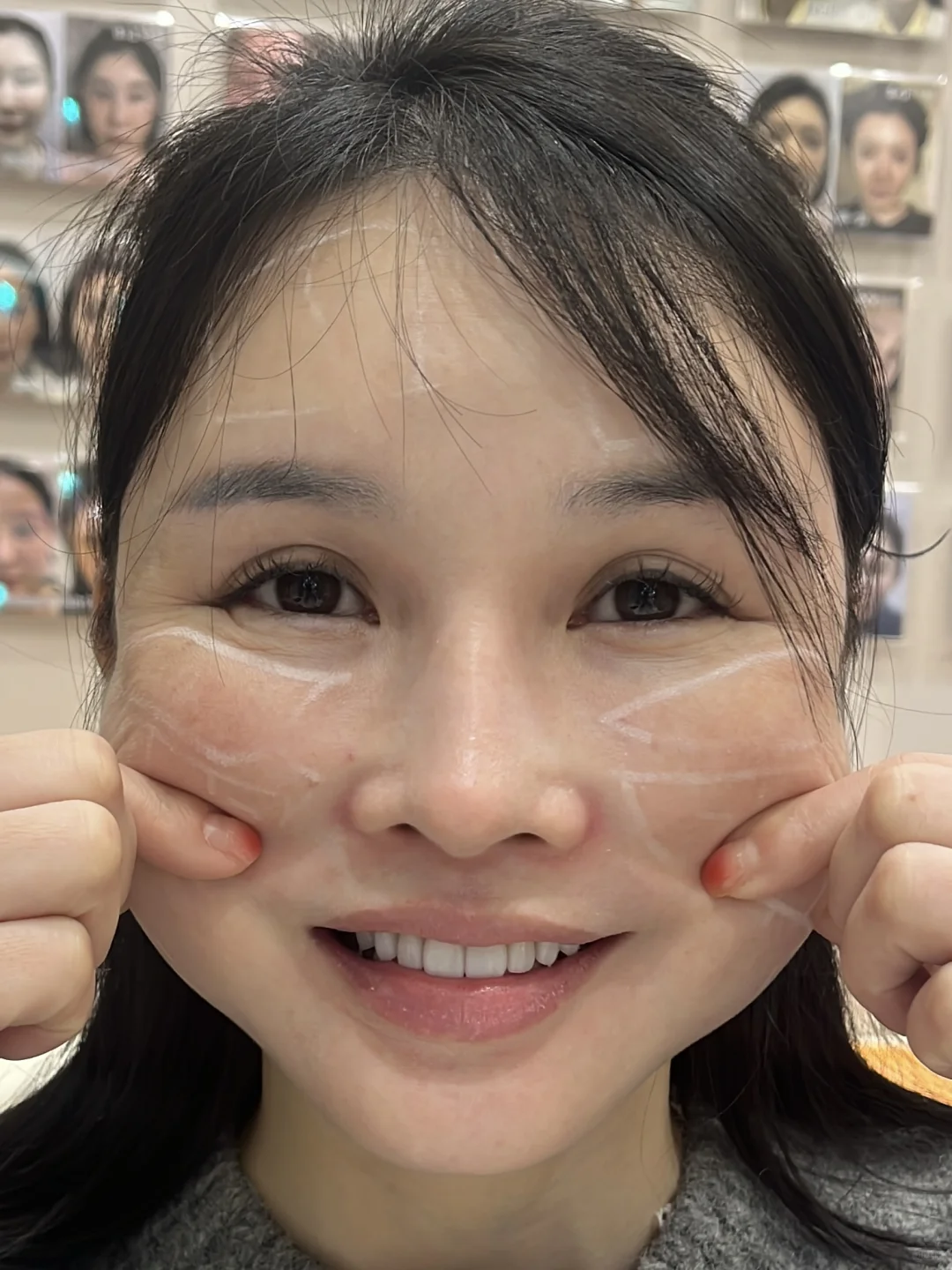 25岁脸这样正常嘛