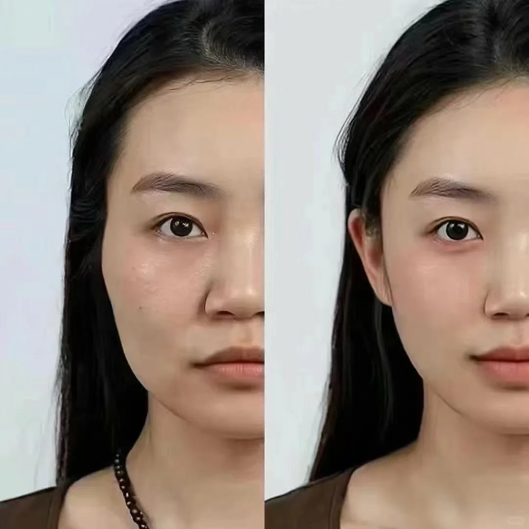 轮廓凹陷脸 变 幼态脸👀 轻松几部就完成