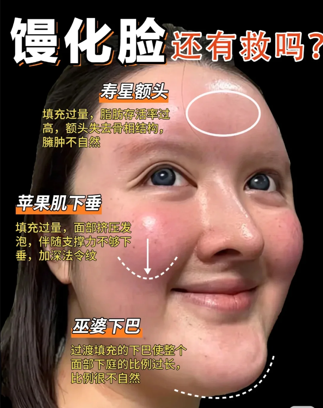 馒化脸