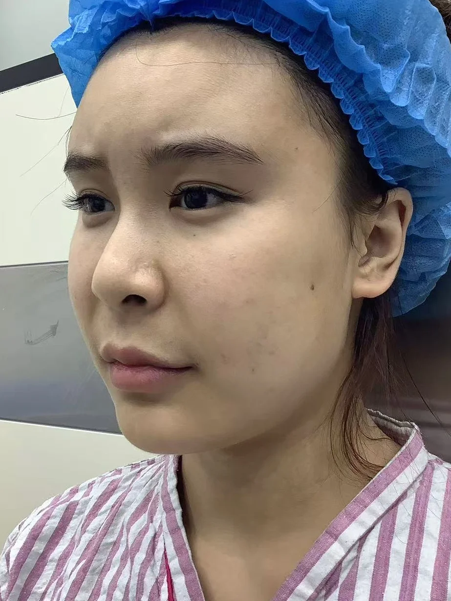 今天要与我的假面馒头脸说再见👋🏻了