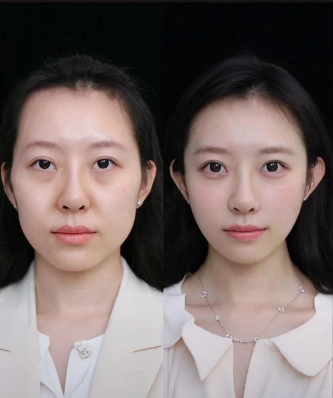 也是体验上女明星的上镜小脸秘诀了！