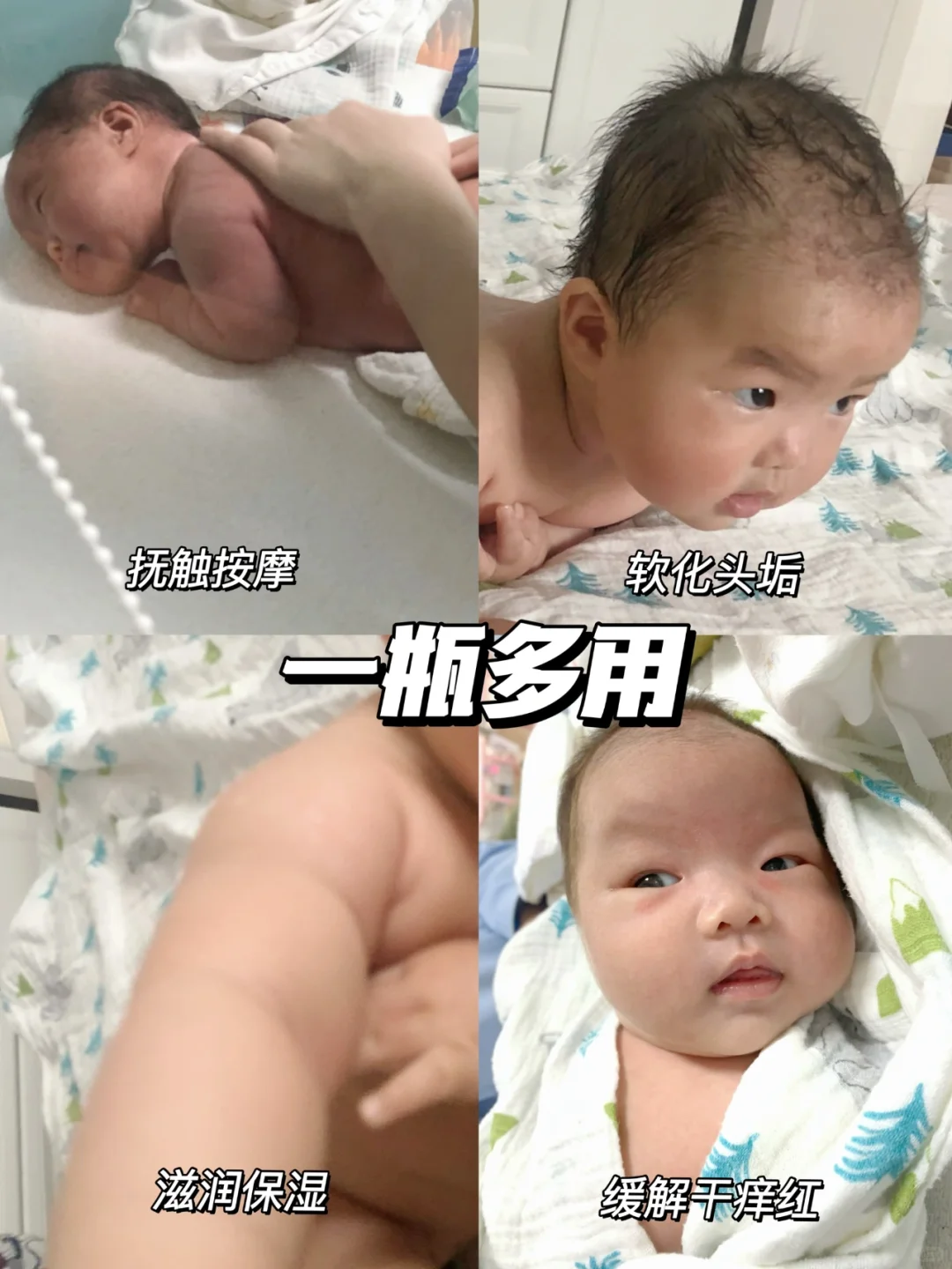 宝宝屁屁护理最全攻略✅男宝女宝护理不一样