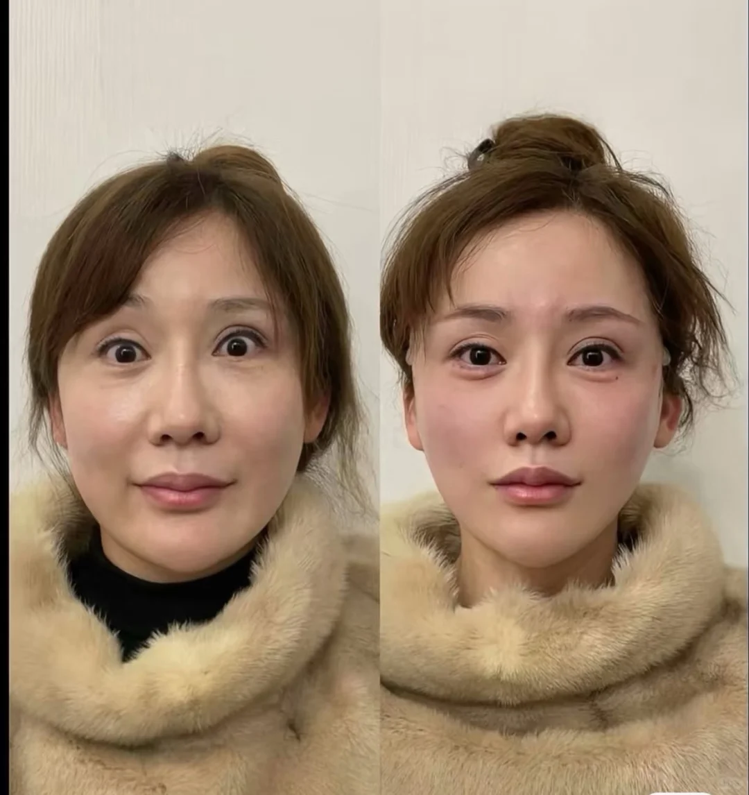 果然 轻薄脸才是yyds！