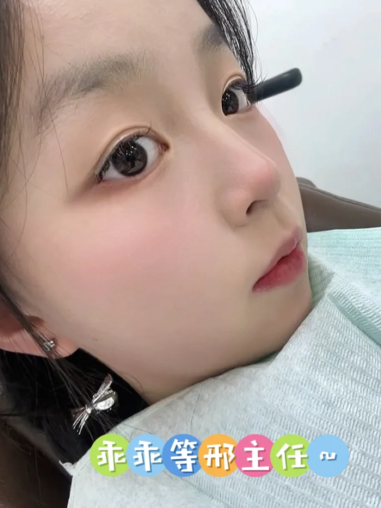 太原正畸 | 女大学生2年钢牙妹毕业分享！