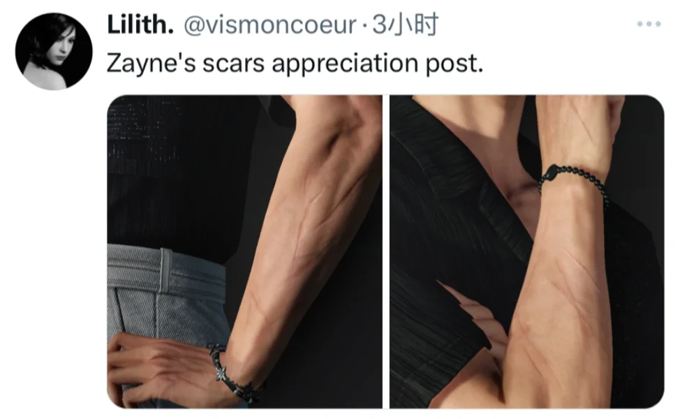 手臂的伤疤😭
