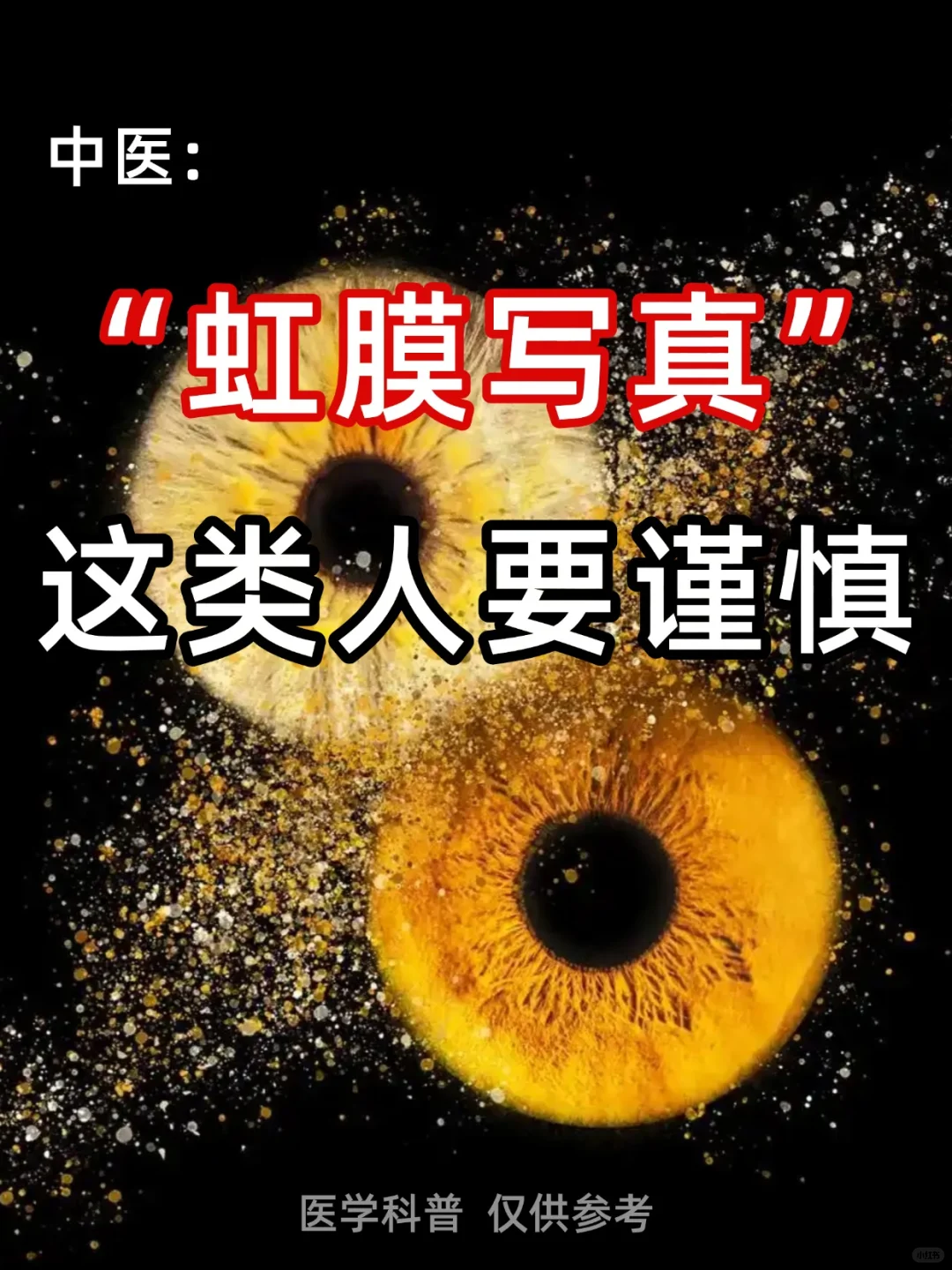 虹膜写真爆火？安全吗？中医：这类人需谨慎