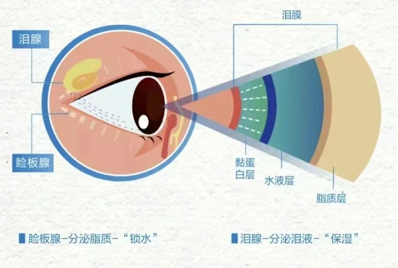 是什么导致眼干？