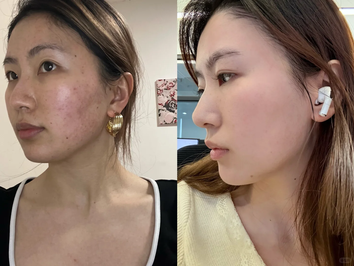 皮肤管理确实有点东西