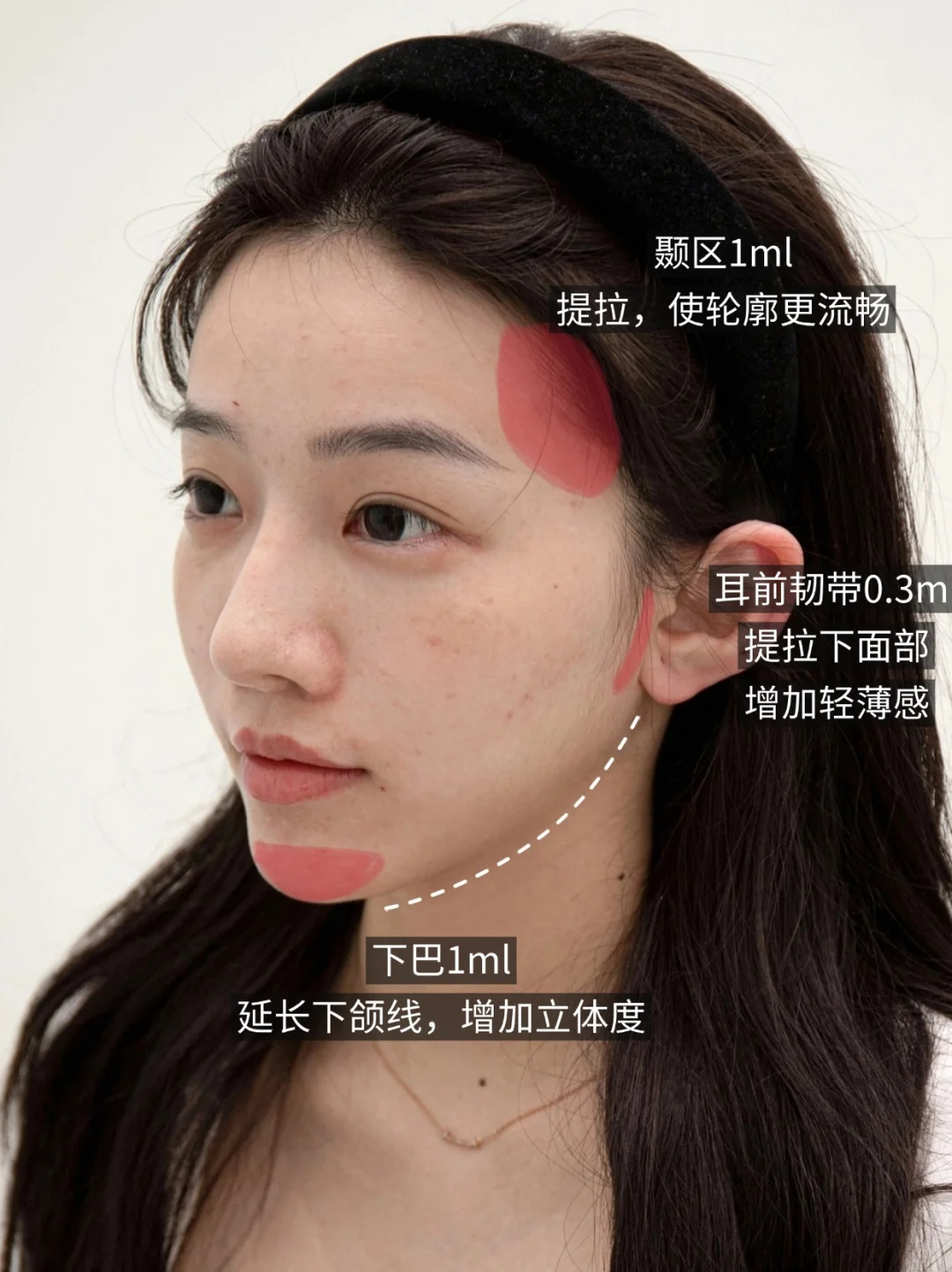 无痛速成版|下颌线清晰了，脸也轻薄了